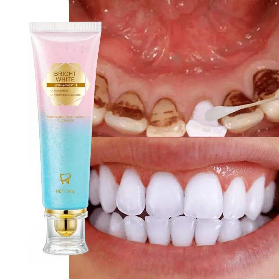 Pâte dentifrice — 1/3